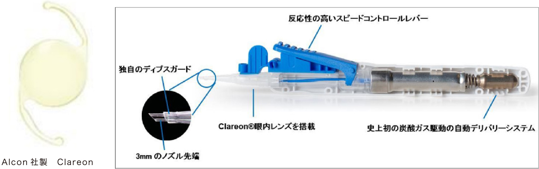 イメージ：単焦点眼内レンズ