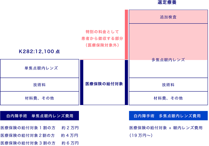 イメージ：選定療養について