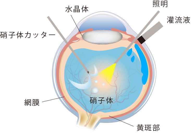 イメージ：正常な状態